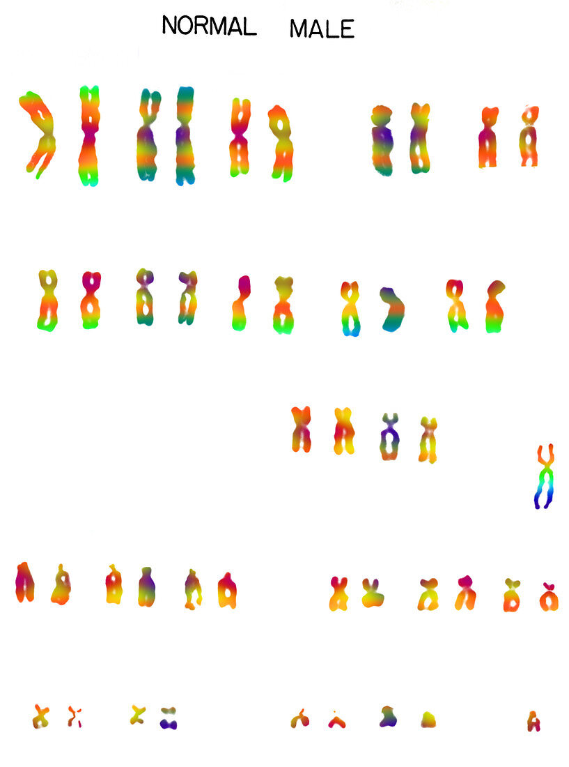 Male karyotype