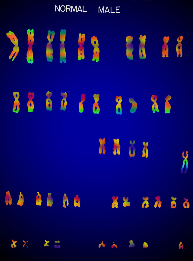 Male karyotype