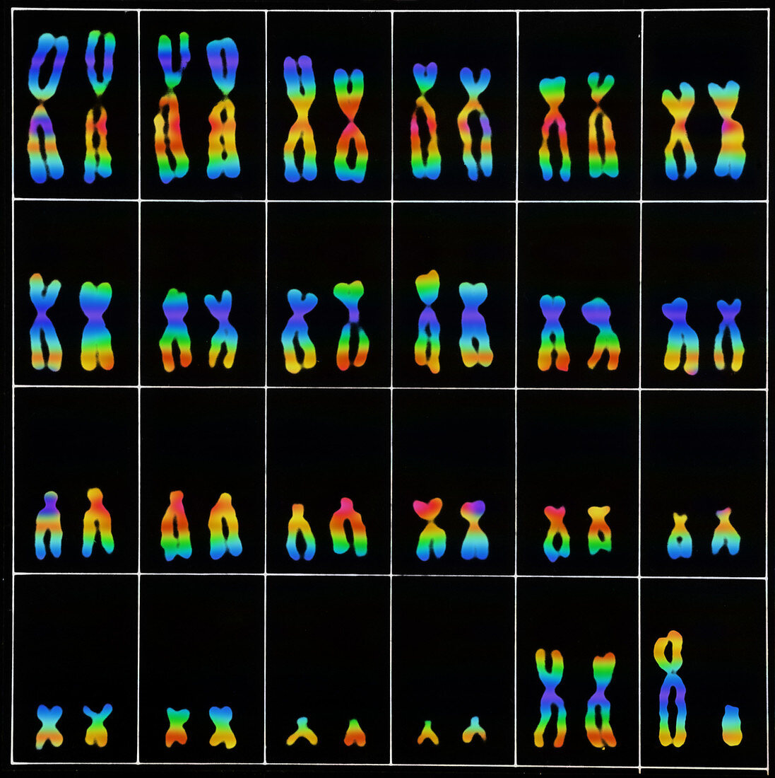 Male karyotype