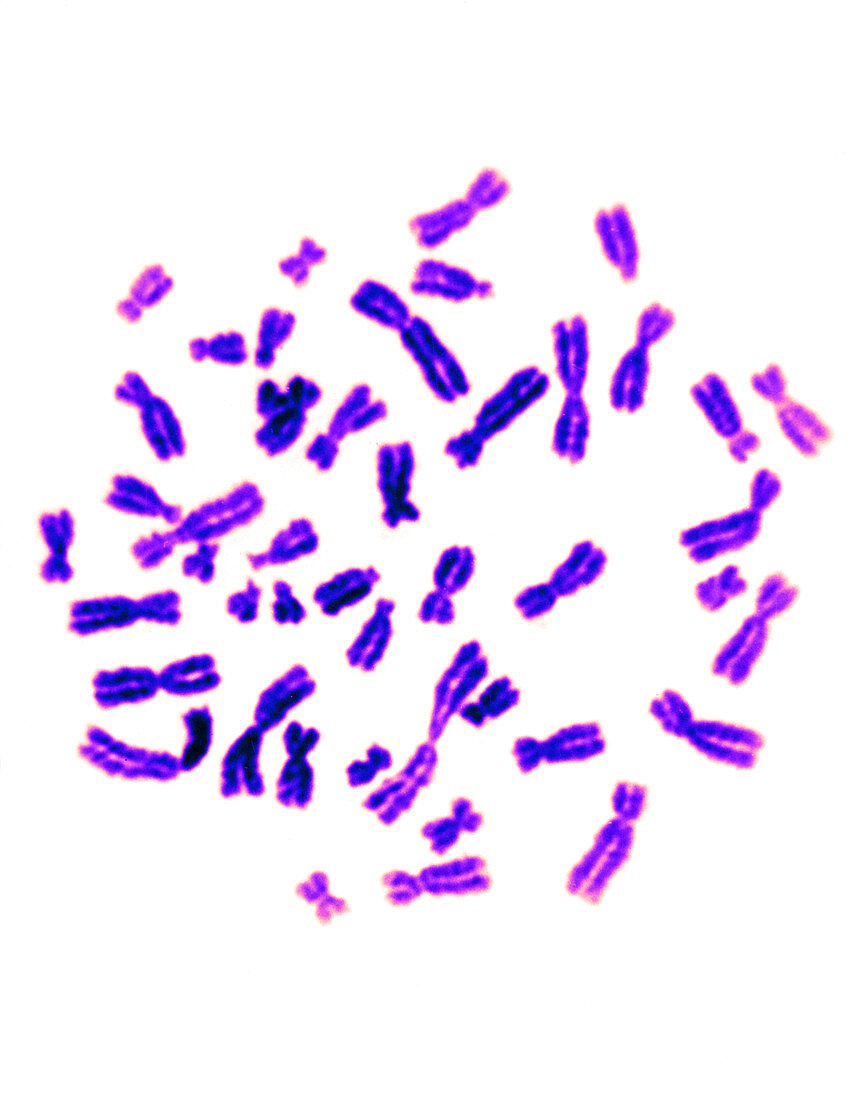 Normal female karyotype