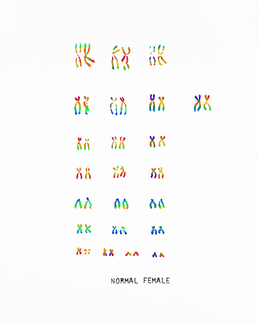 Normal Female Karyotype