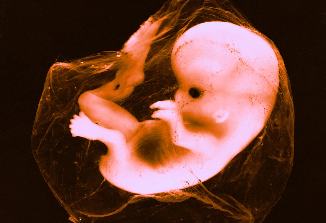 8-Week Human Fetus