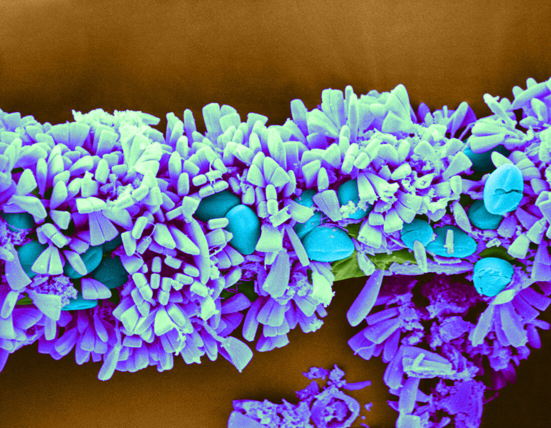 Epiphytic Diatoms,SEM