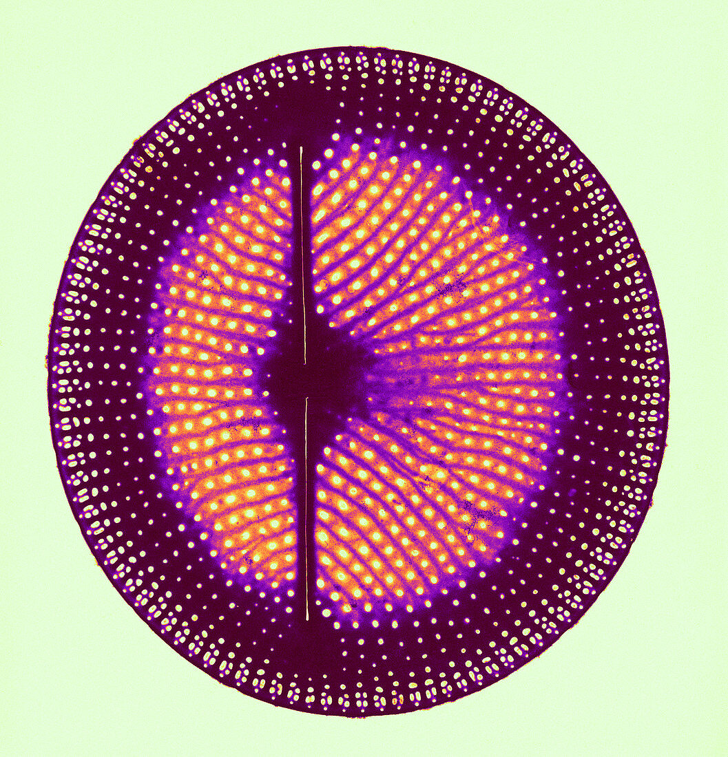 Diatom,Anorthoneis Excentrica,TEM