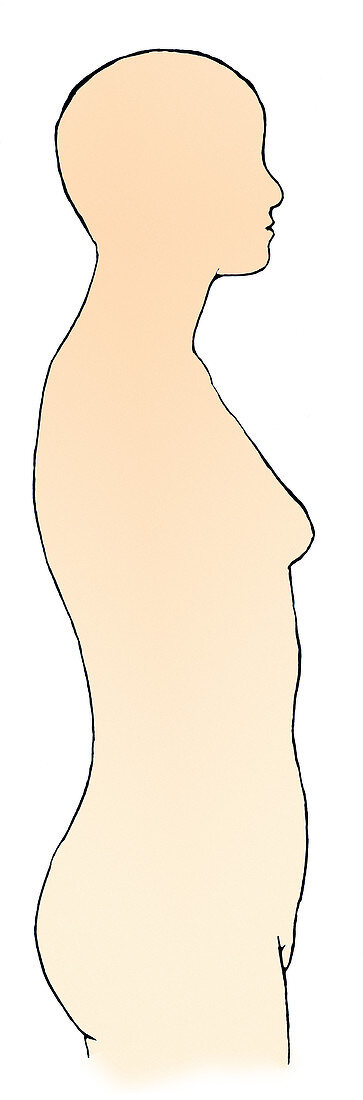 Profile of Adult Female