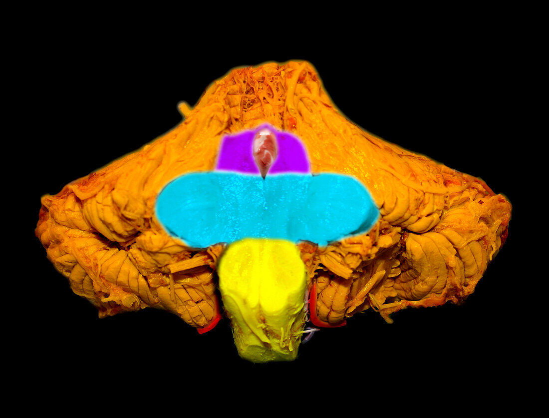 Normal Brainstem and Cerebellum