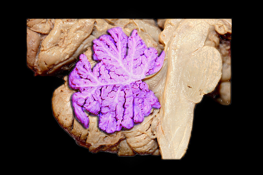 Colour Enhanced Human Cerebellar Vermis