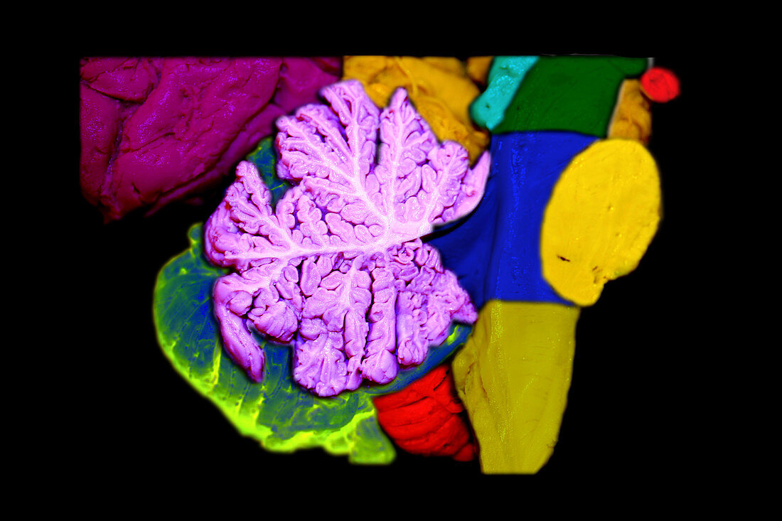 Brainstem,Cerebellum and Occipital Lobe