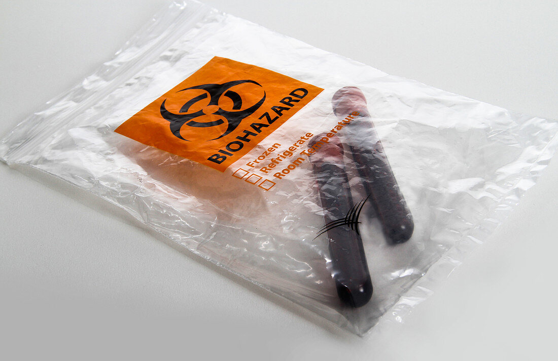 Blood Samples in a Biohazard Bag