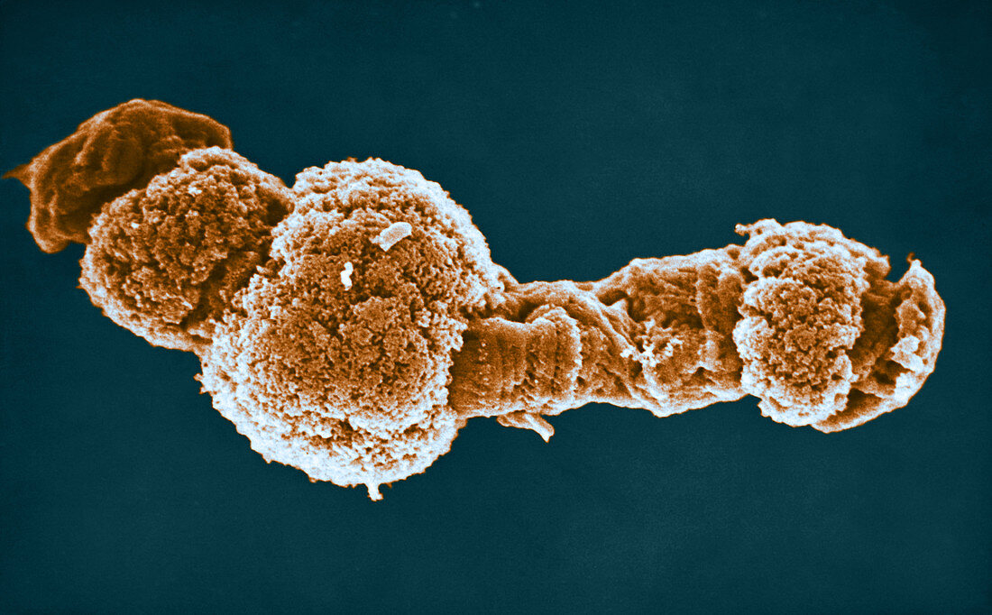 Human Polytene Chromosomes,SEM