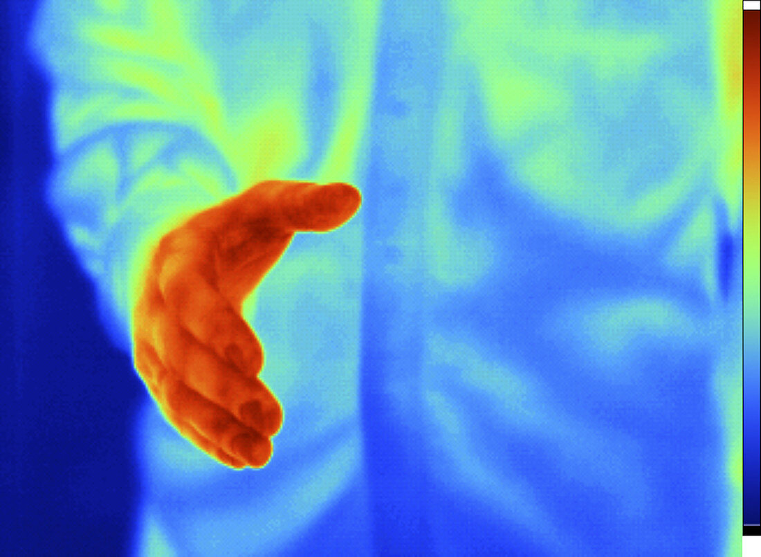 Thermogram of an Extended Hand