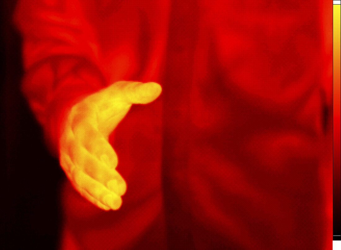 Thermogram of an Extended Hand
