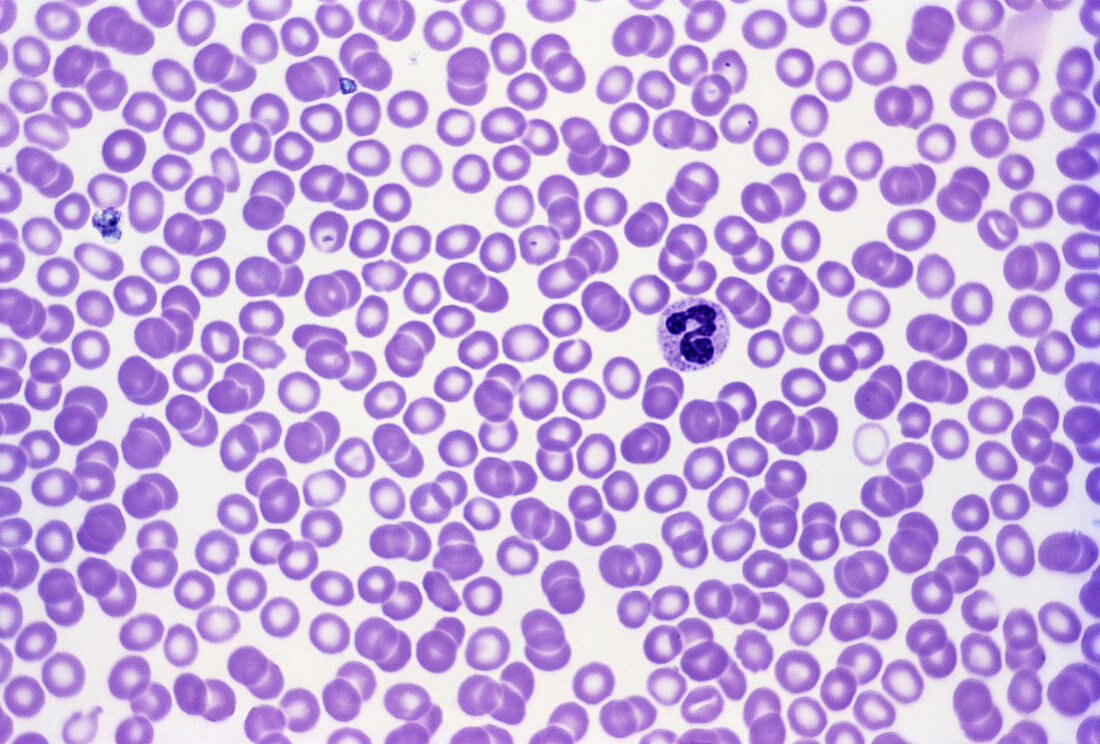 Normal Blood Smear (LM)