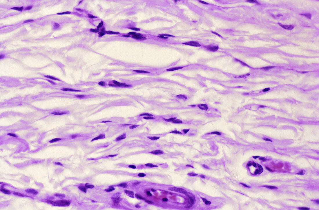 Loose Connective Tissue