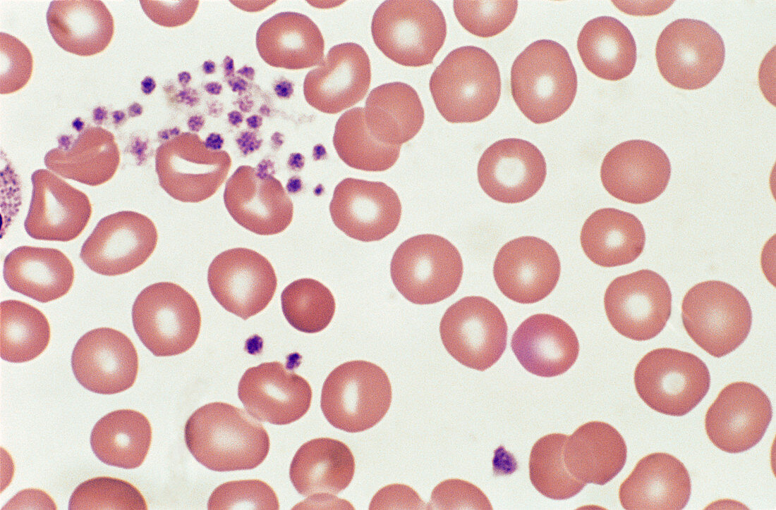 Red Blood Cells and Platelets (LM)