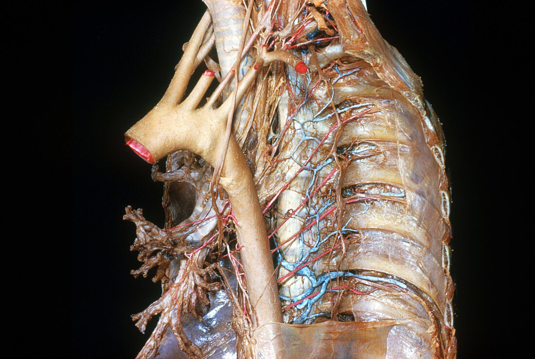 Thoracic Aorta