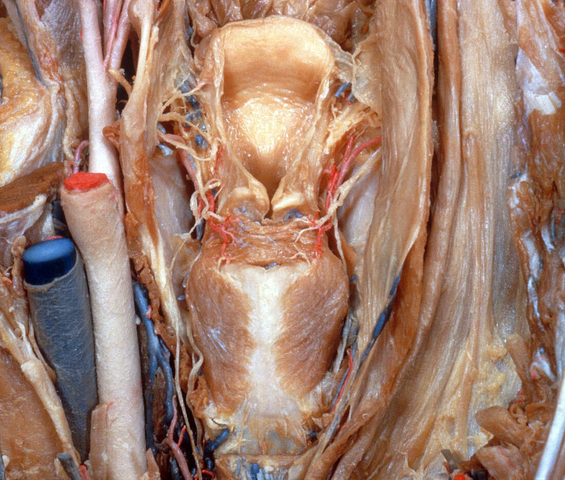 Dissected Larynx