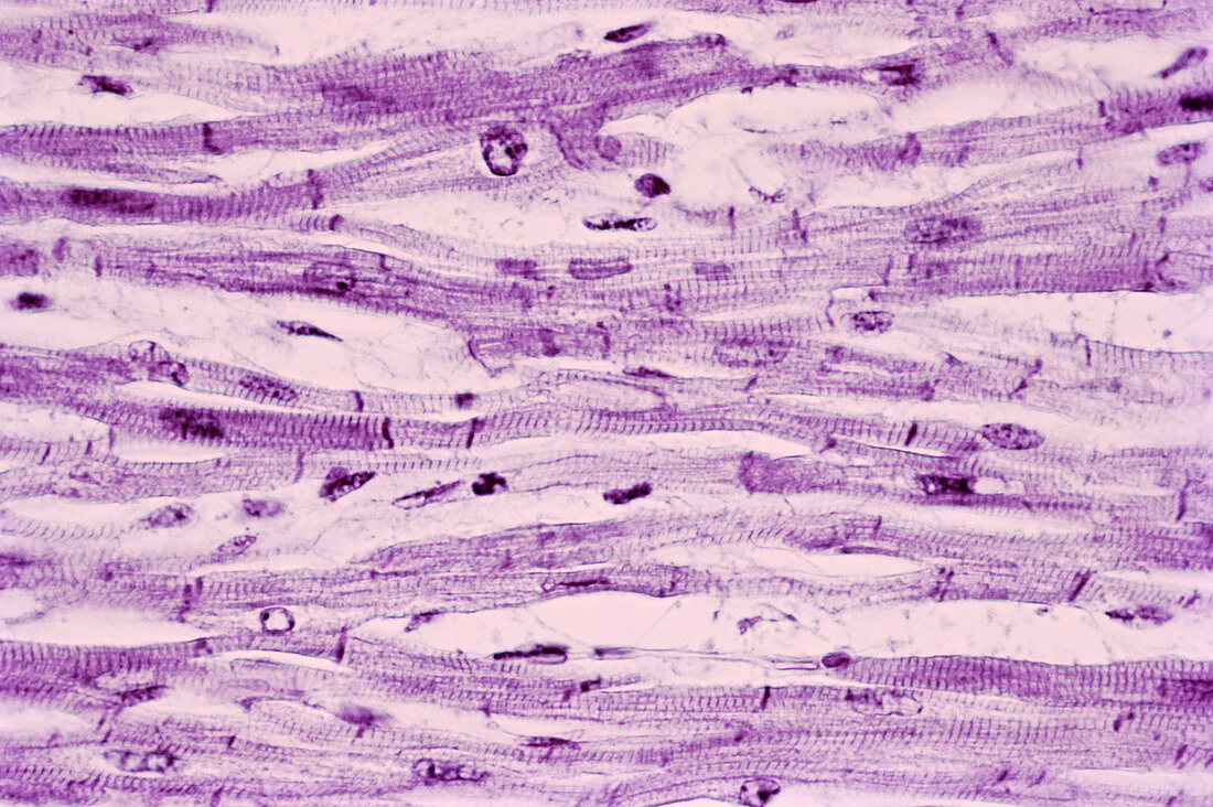 Cardiac Muscle (LM)