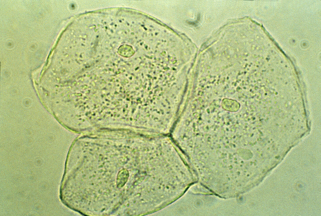 Cheek cells,light micrograph
