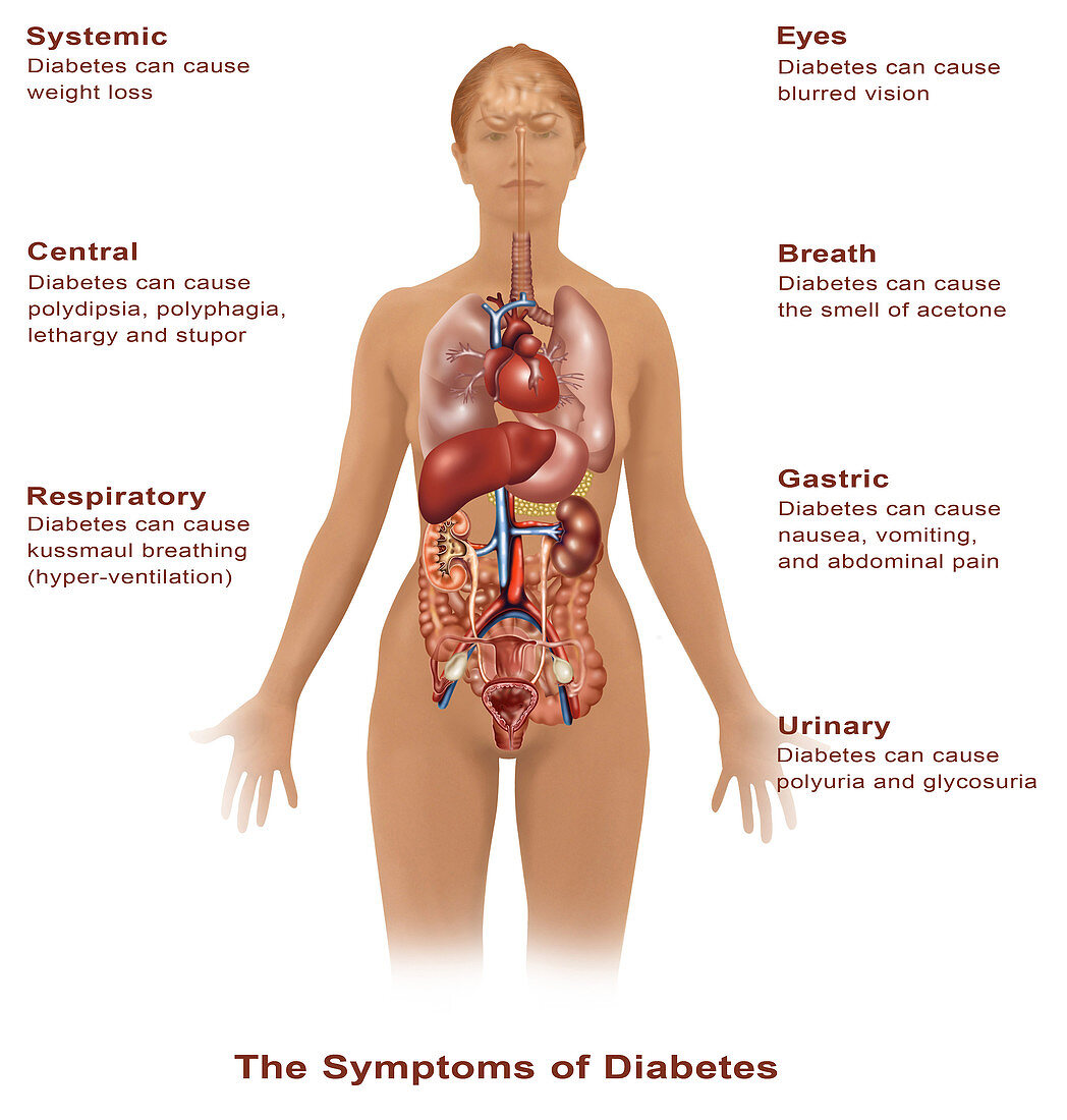 Symptoms of Diabetes