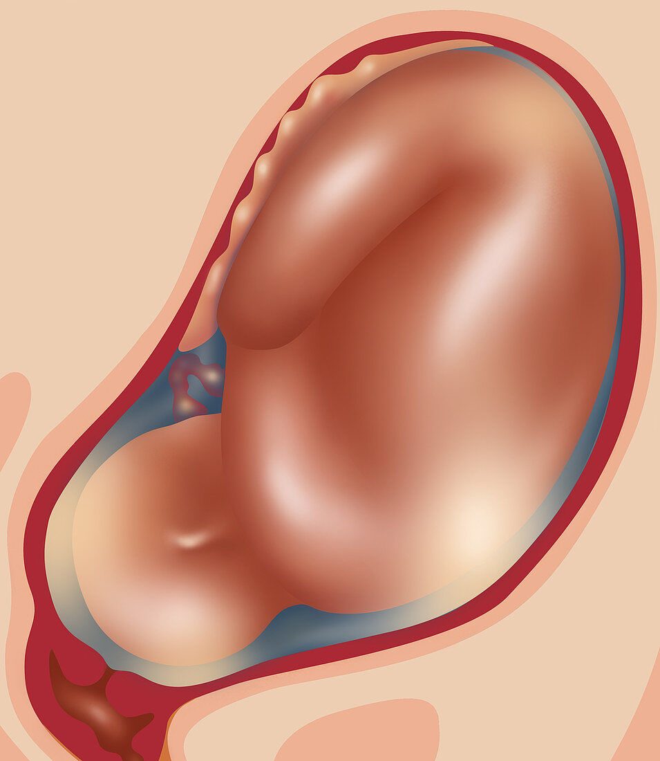 Fetal Growth - Month 8