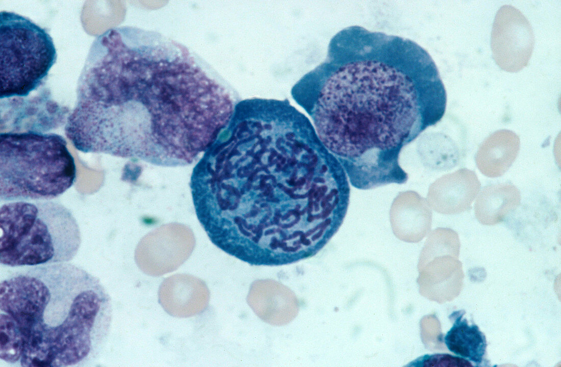 Blood Cells in Prophase,LM