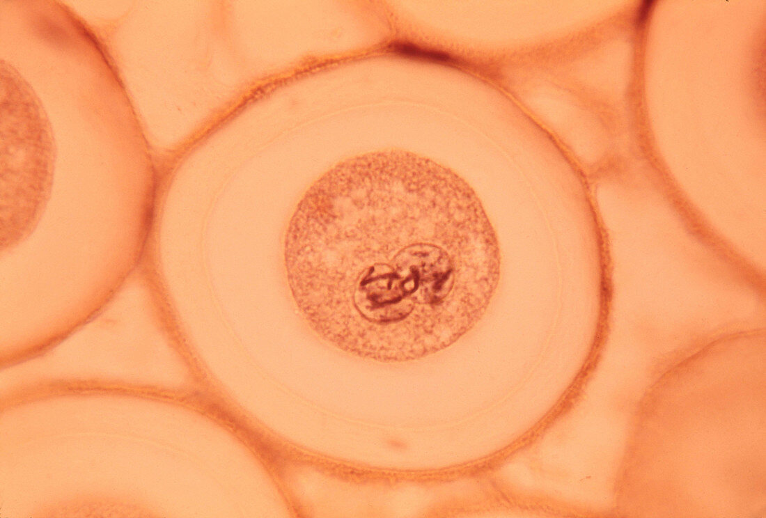 Roundworm Cells in Prophase,LM