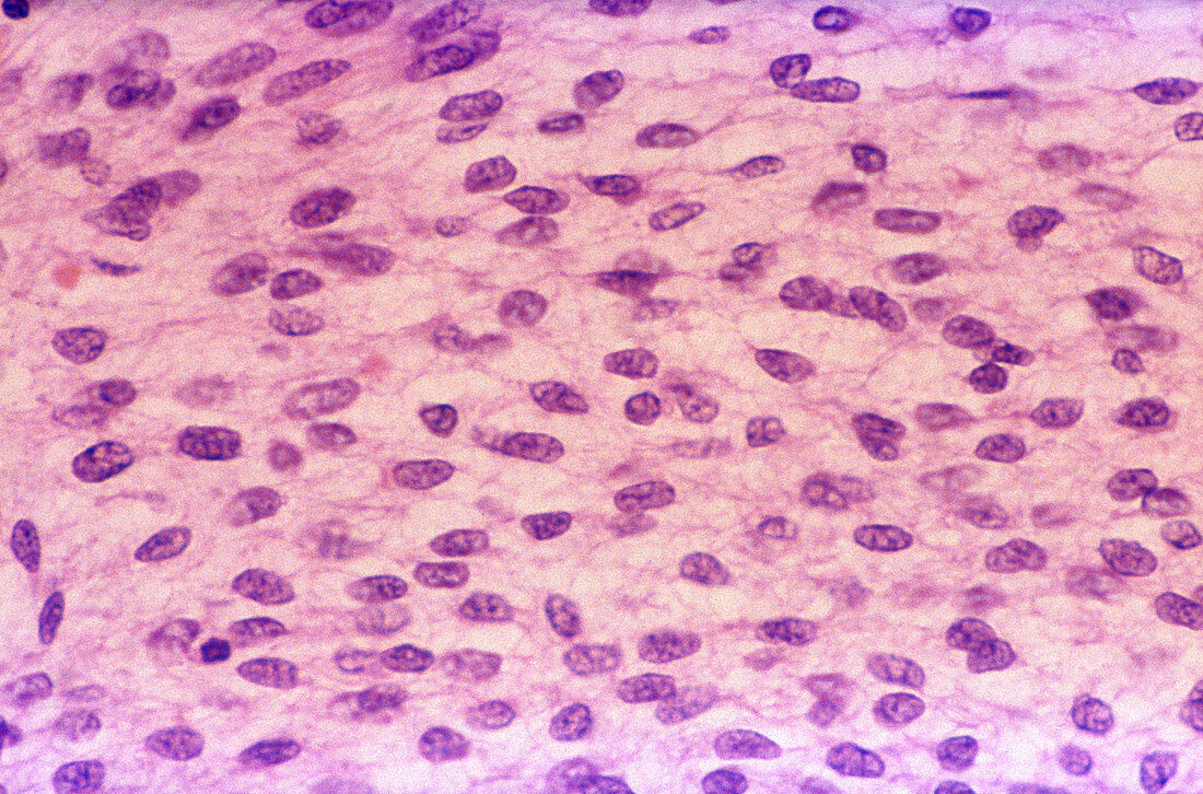Embryonic Mesenchyme,LM