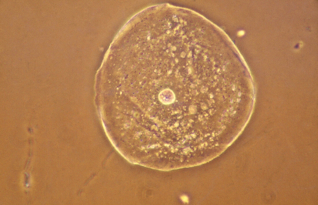 Epithelial Cell from Human Cheek,LM