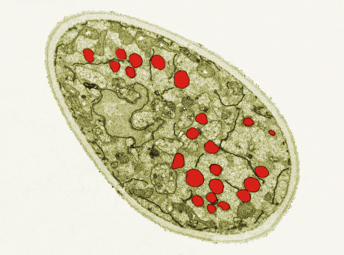 TEM of Saccharomyces Cerevisiae