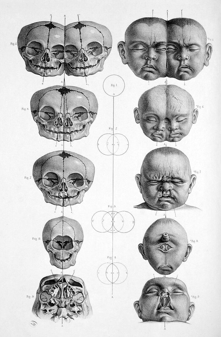 Surgical Anatomy,1856