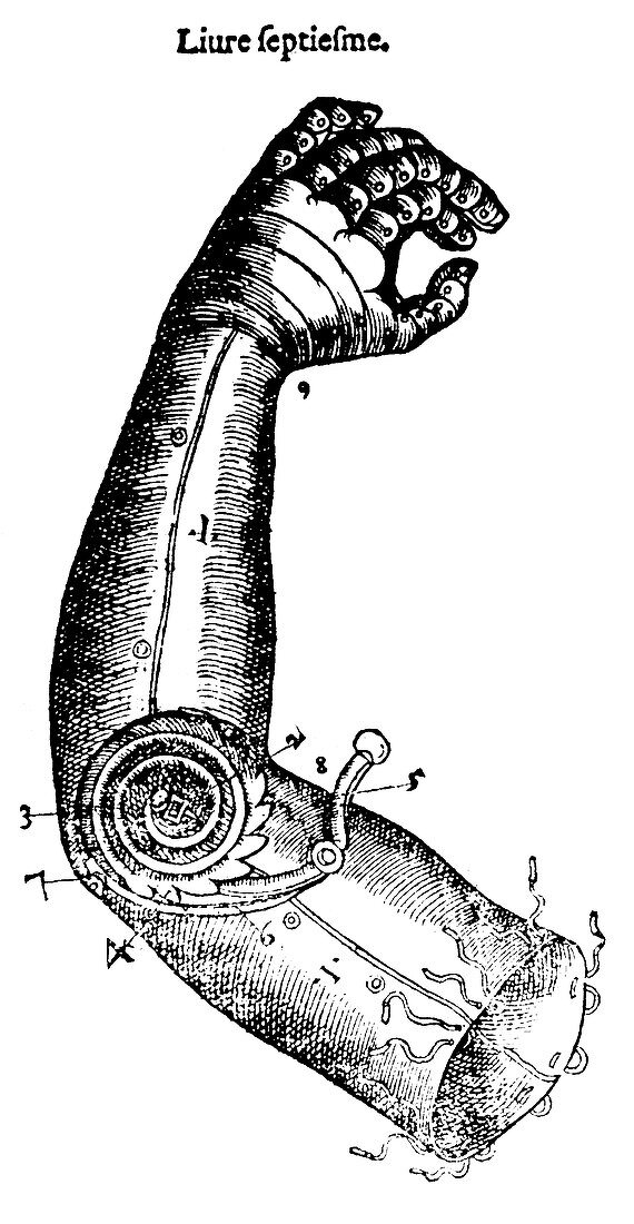 Artificial Arm Designed by Ambroise Pare,