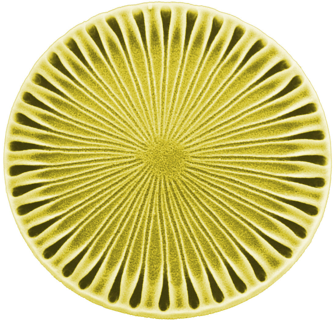 Diatom - Paralia Sol