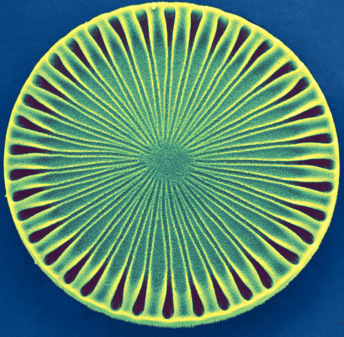 Diatom - Paralia Sol