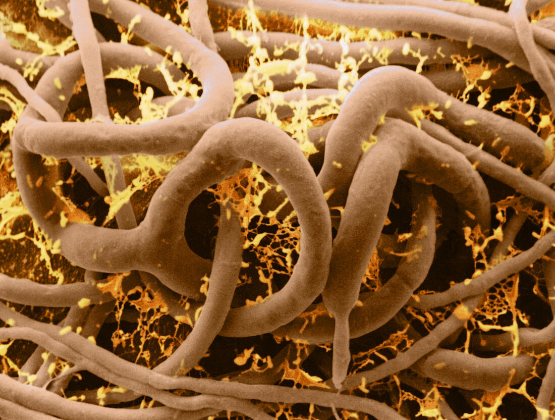 Arthrobotrys oligospora,SEM