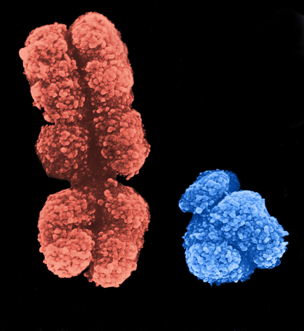 X and Y Chromosomes (SEM)