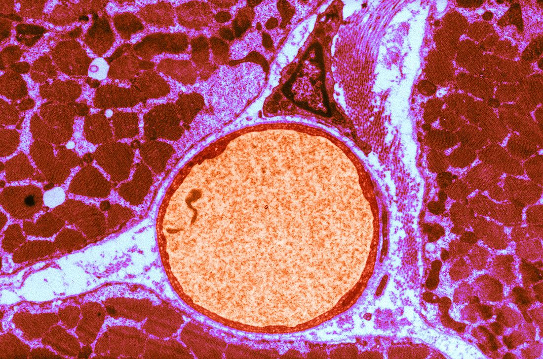 Capillary with Endothelial Cytoplasm,TEM