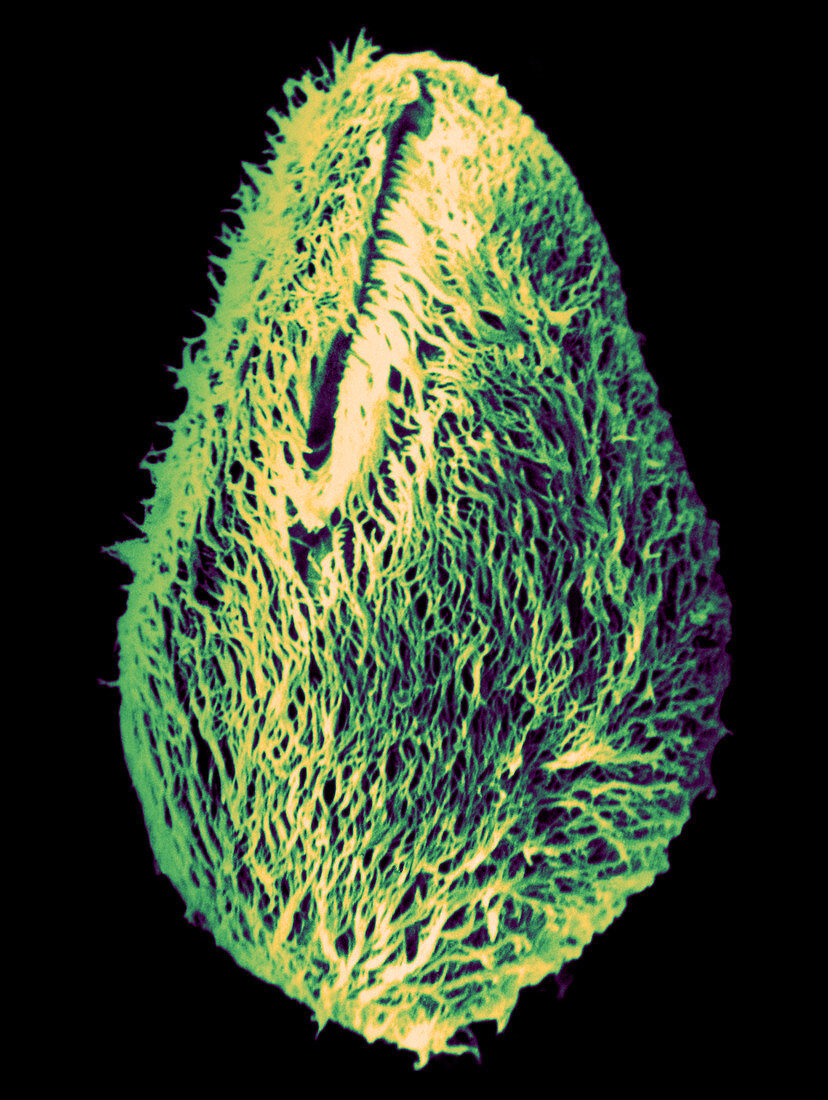 Nyctotherus ovalis (SEM)