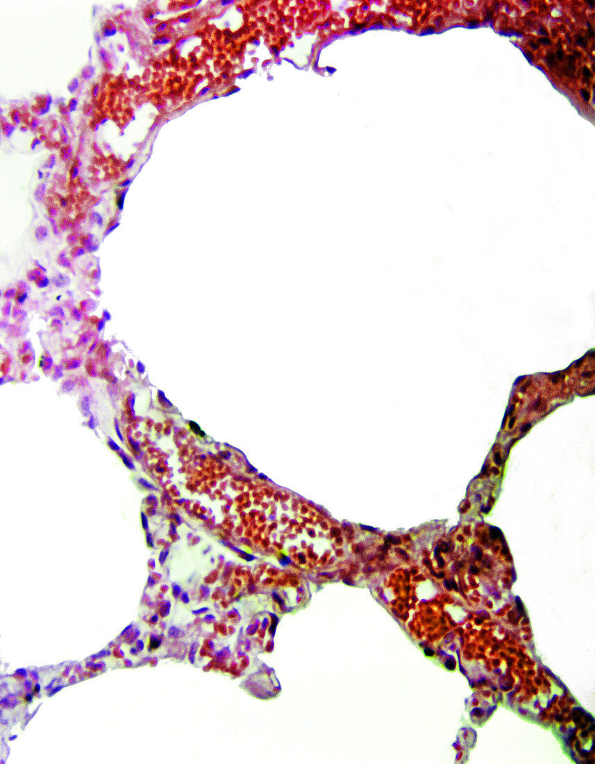 Alveoli in Normal Lung,LM