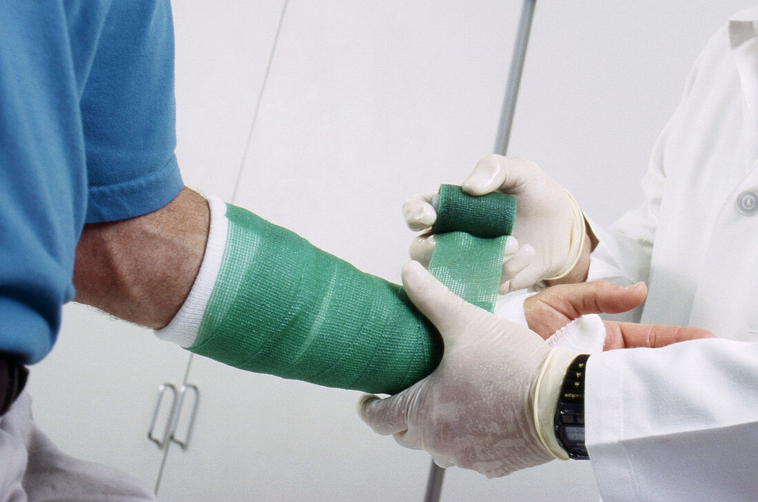 Doctor Putting Cast on a Broken Arm