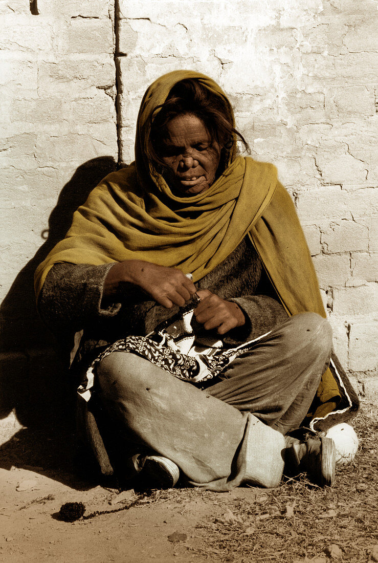 Woman with Leprosy