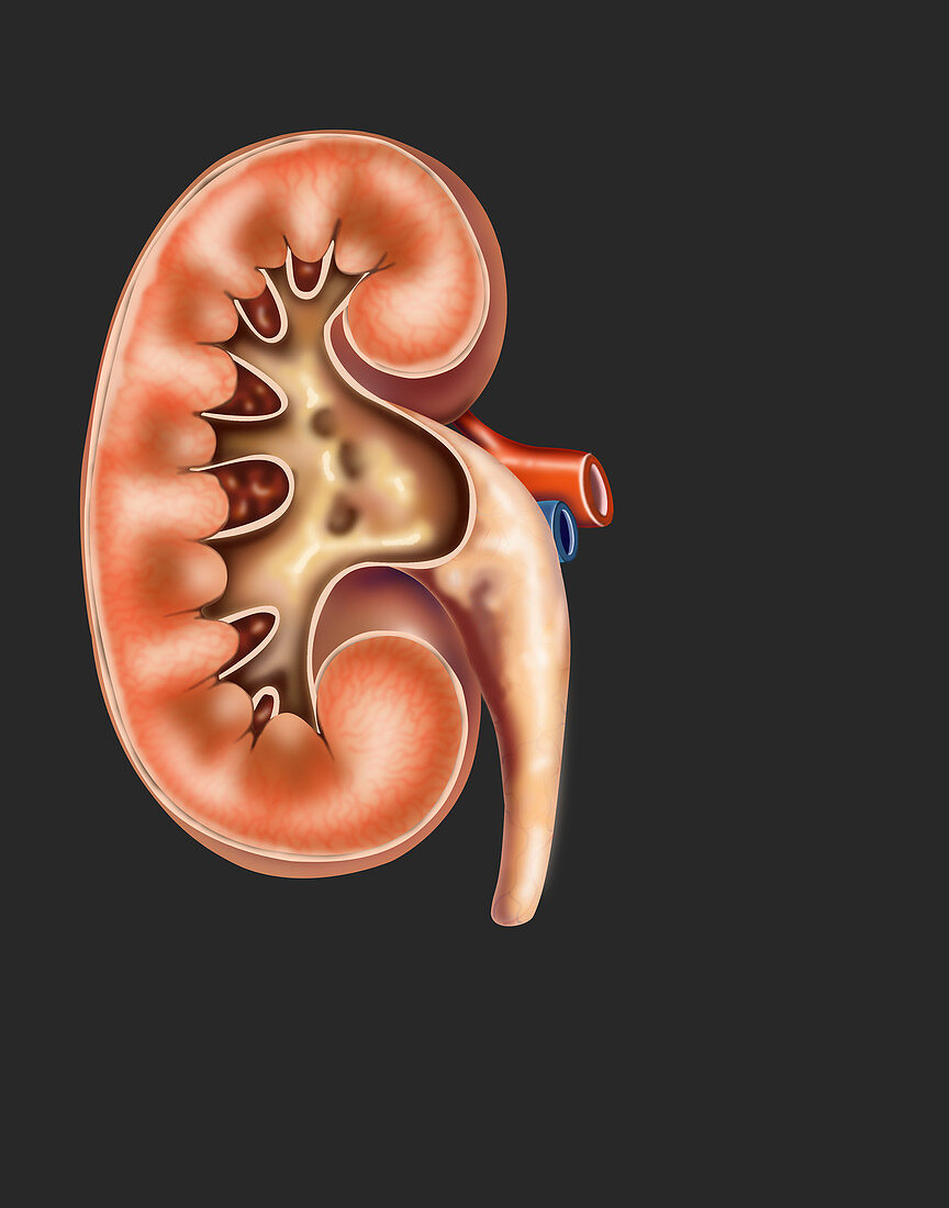 Right Kidney