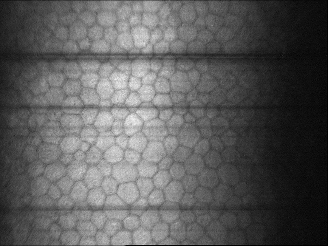 Corneal Endothelial Cells