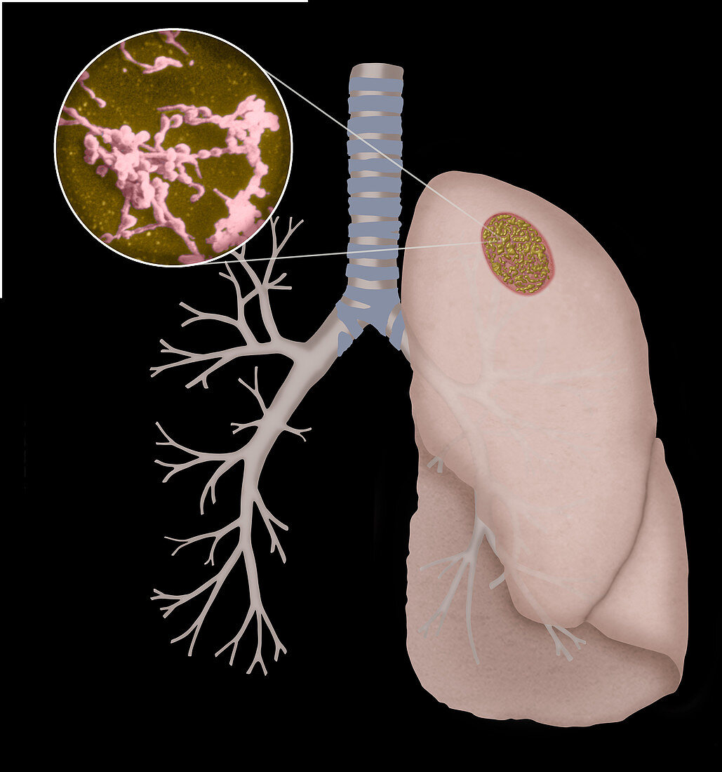 Mycoplasma Pneumoniae,Illustration