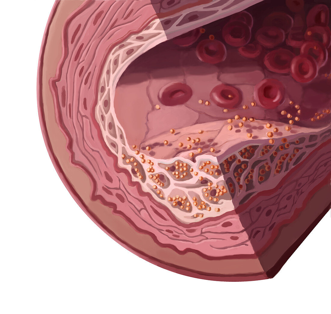 Cholesterol,Illustration