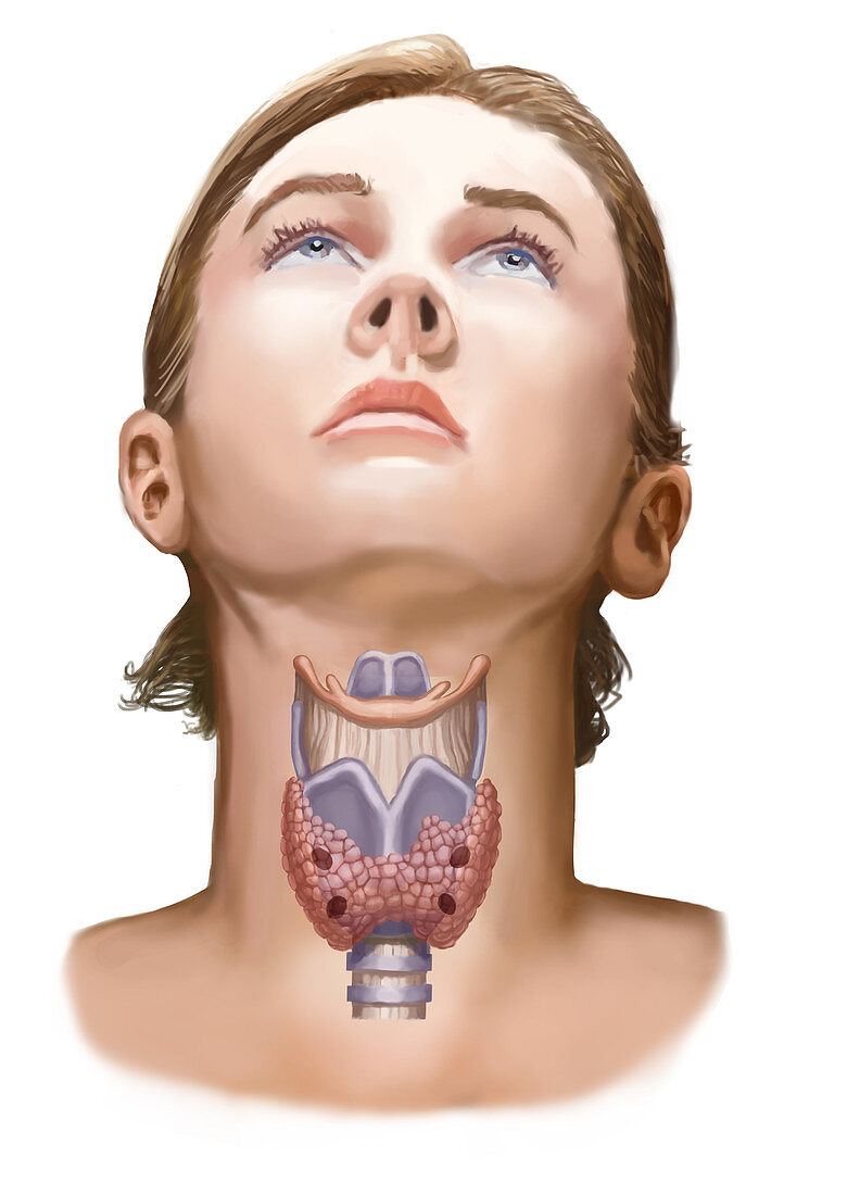 Thyroid,Illustration