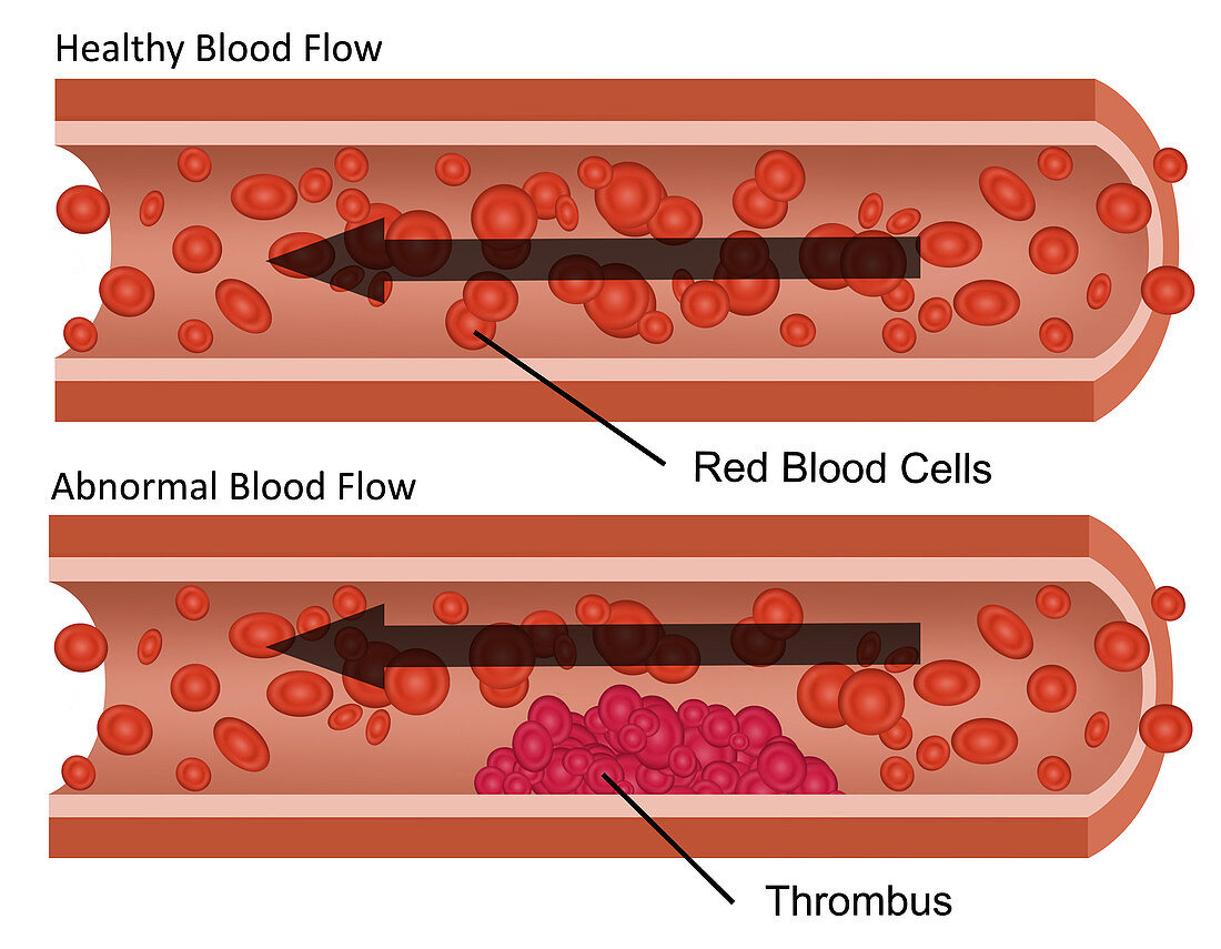 Blood Flow,Illustration