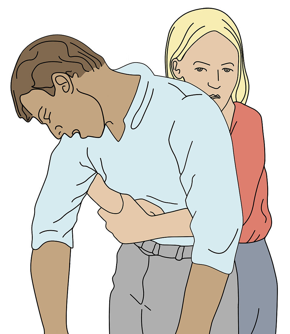 Heimlich Manoeuvre,Illustration