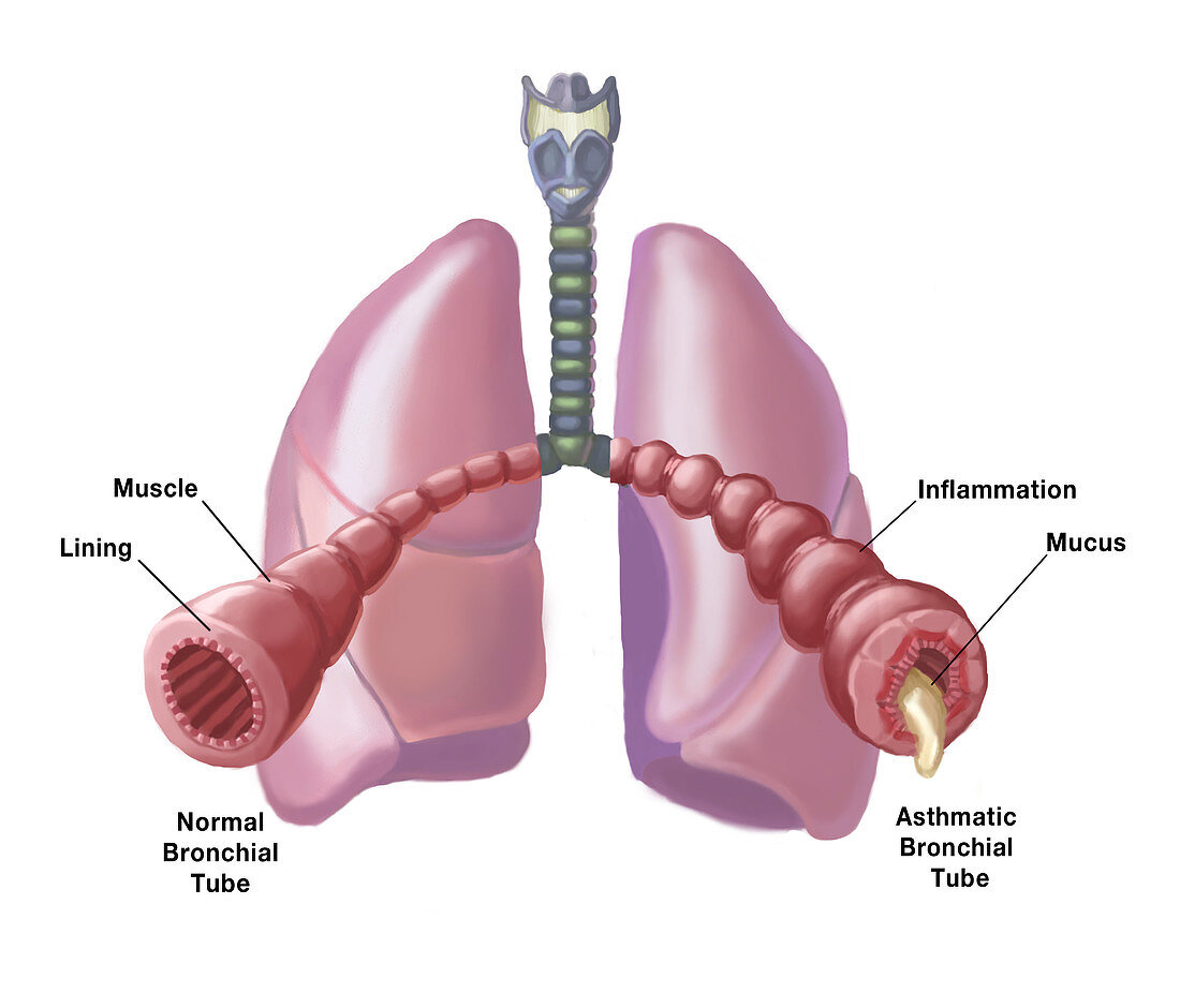 Bronchial Tubes,Illustration