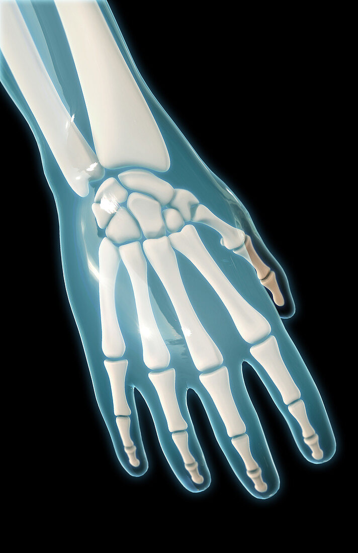 Bones of the Hand,Illustration